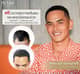 Slider image (10) The Best Medical Hair Center by Dr. Orn 